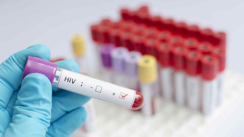 Mujer en Estados Unidos supera el VIH con transparente de células madre